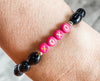 XOXO Bracelets by Erimish